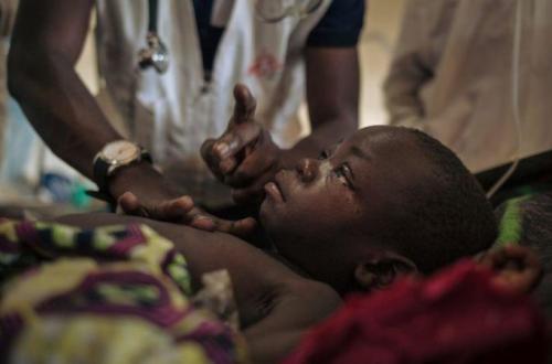 Nord-Kivu : 36 cas suspects de la rougeole détectés dans six zones de santé depuis janvier 2024