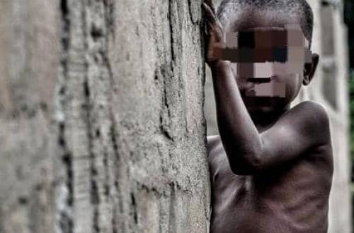 Malnutrition chronique en RDC, L'Ituri en tête des provinces les plus touchées