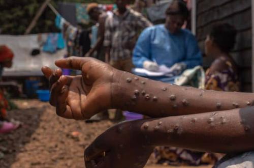 La vaccination des contacts se poursuit en zones de santé de Beni et Mutwanga