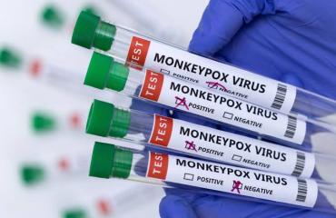 Oui, Le virus mpox peut également se transmettre sexuellement