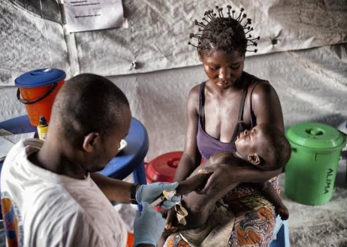 Ituri : La Division Provinciale de la Santé note une baisse des cas de la rougeole