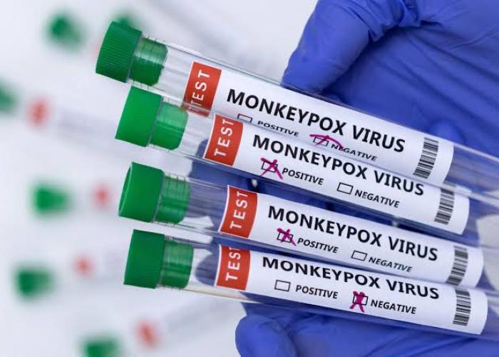 Oui, Le virus mpox peut également se transmettre sexuellement