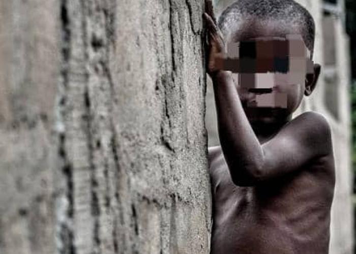Malnutrition chronique en RDC, L'Ituri en tête des provinces les plus touchées