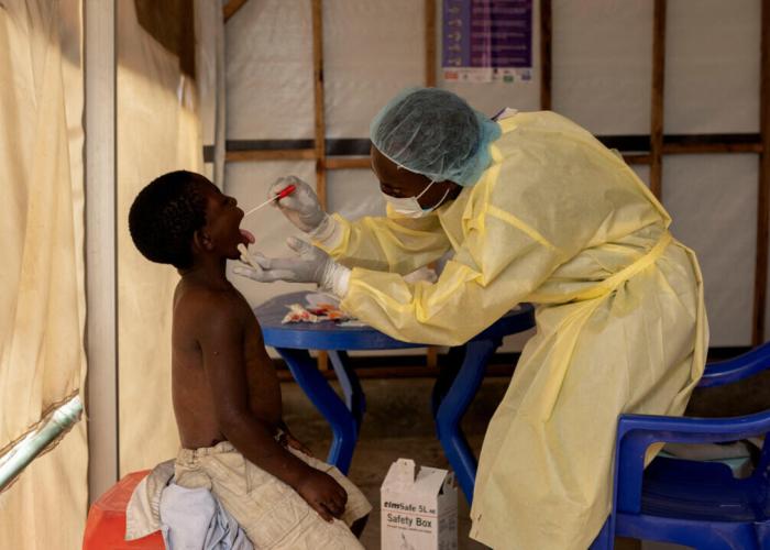 Épidémie de Mpox, Le Maroc enregistre son premier cas