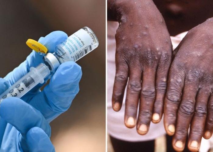 Plus de 500 000 personnes vaccinées contre le Mpox